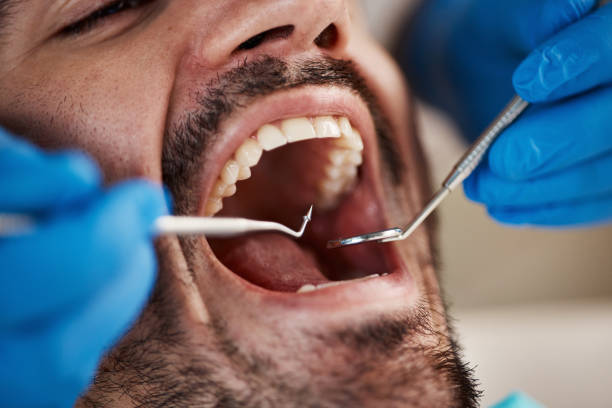 Best Emergency Dentist for Special Needs Patients in Springfield, MA