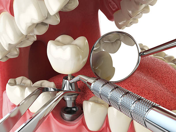 Best Emergency Cosmetic Dentistry in Springfield, MA